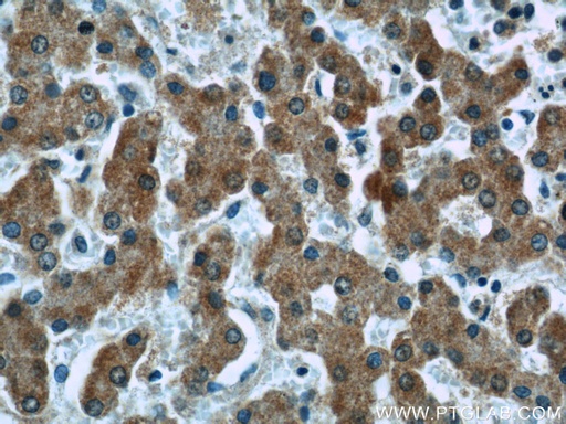 [66154-1-IG-150UL] Complement factor B Monoclonal antibody