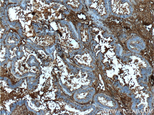 [66156-1-IG-150UL] Ceruloplasmin Monoclonal antibody