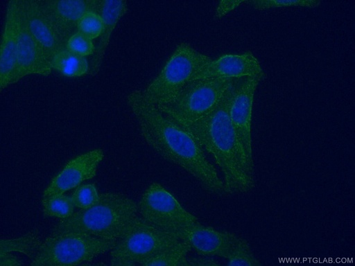 [66157-1-IG-150UL] C3/C3b/C3c Monoclonal antibody