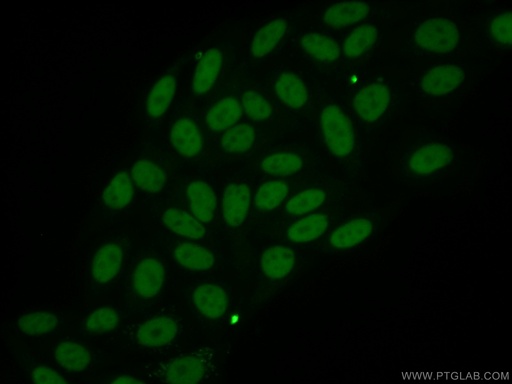 [66160-1-IG-20UL] ANP32B Monoclonal antibody