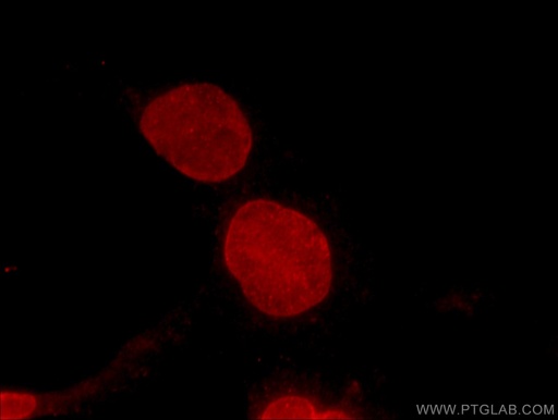 [66161-1-IG-20UL] BMI1 Monoclonal antibody