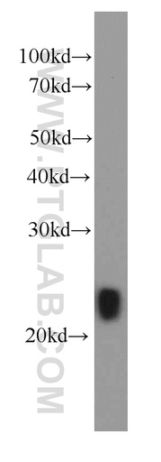 [66163-1-IG-20UL] IL-29 Monoclonal antibody