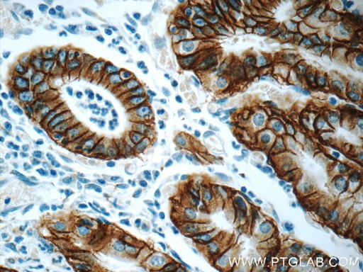 [66167-1-IG-150UL] Claudin 18 Monoclonal antibody