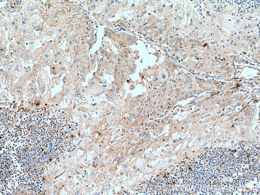 [66171-1-IG-150UL] Transferrin Monoclonal antibody