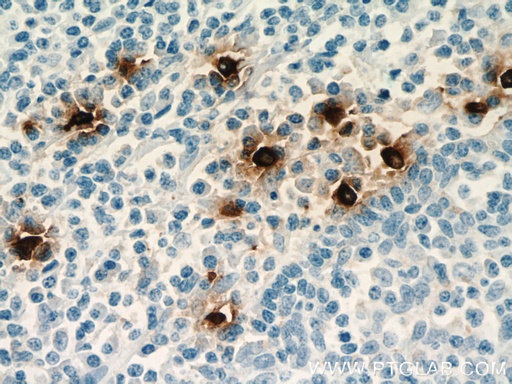 [66174-1-IG-20UL] TPSAB1 Monoclonal antibody