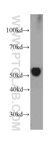 [66175-1-IG-150UL] Vitamin D binding protein Monoclonal antibody