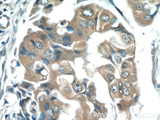 [66178-1-IG-150UL] Zinc Alpha 2 Glycoprotein Monoclonal antibody