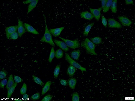 [66179-1-IG-20UL] PSMD4 Monoclonal antibody