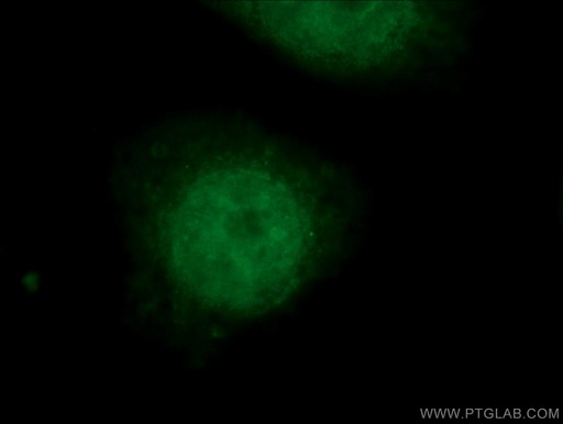[66182-1-IG-20UL] SMARCE1 Monoclonal antibody