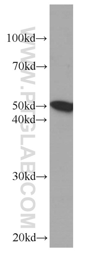 [66186-1-IG-150UL] Fibrinogen Beta Chain Monoclonal antibody