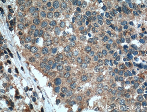 [66189-1-IG-150UL] STIM1 Monoclonal antibody