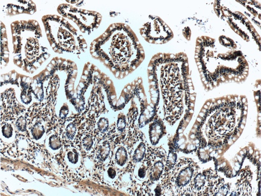 [66190-1-IG-150UL] IL-22RA2 Monoclonal antibody