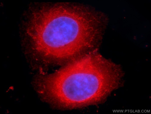 [66191-1-IG-150UL] VAPB Monoclonal antibody