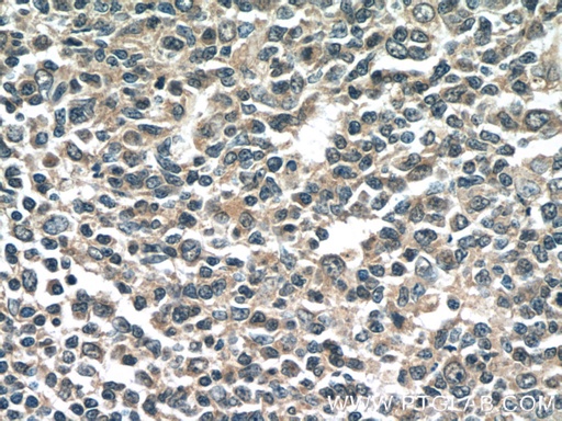 [66202-1-IG-20UL] NINJ2 Monoclonal antibody