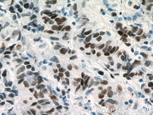 [66204-1-IG-150UL] MCM2 Monoclonal antibody