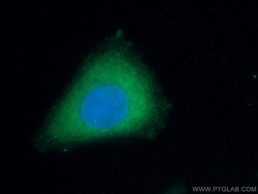 [66206-1-IG-150UL] Apolipoprotein AI Monoclonal antibody