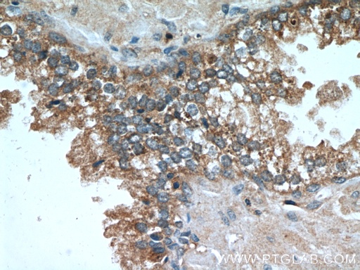 [66207-1-IG-150UL] Beta-2-Microglobulin Monoclonal antibody
