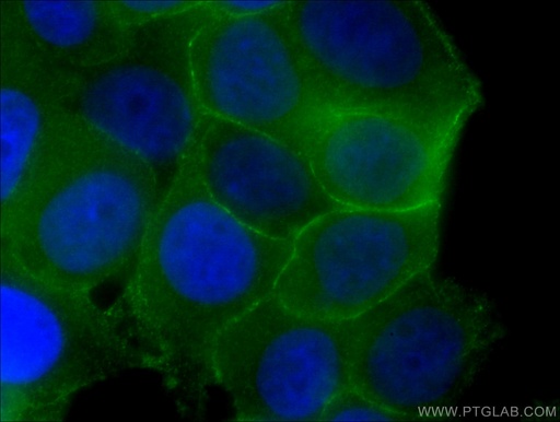 [66208-1-IG-20UL] p120 Catenin Monoclonal antibody