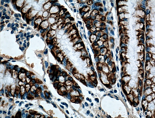 [66209-1-IG-20UL] ST6GALNAC6 Monoclonal antibody