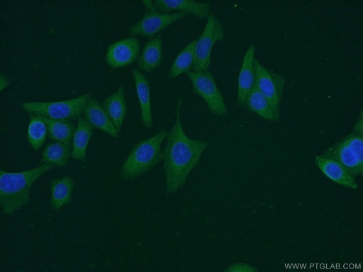 [66210-1-IG-150UL] JNK Monoclonal antibody