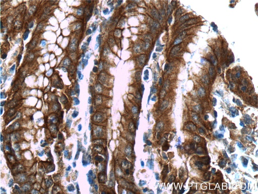 [66221-1-IG-20UL] Alpha E-Catenin Monoclonal antibody