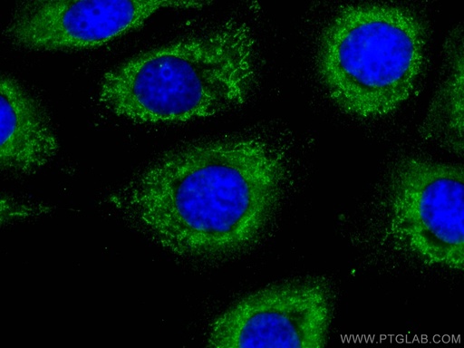 [66227-1-IG-150UL] S100A10 Monoclonal antibody