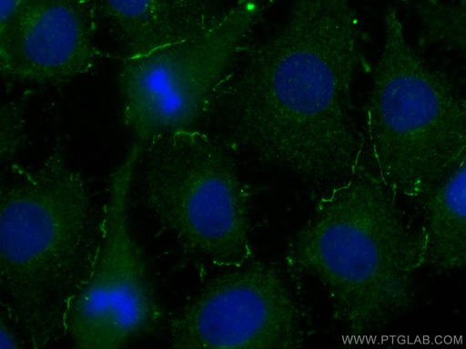[66230-1-IG-20UL] UCHL1/PGP9.5 Monoclonal antibody