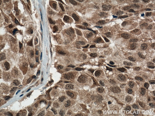 [66234-1-IG-150UL] p38 MAPK Monoclonal antibody