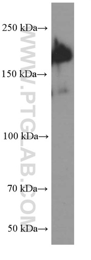 [66236-1-IG-20UL] SALL4 Monoclonal antibody