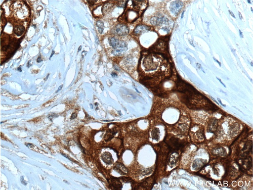 [66237-1-IG-150UL] Mammaglobin A Monoclonal antibody