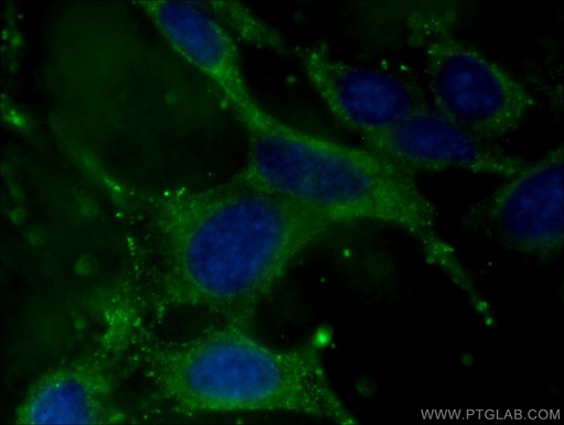 [66239-1-IG-20UL] Adiponectin Monoclonal antibody