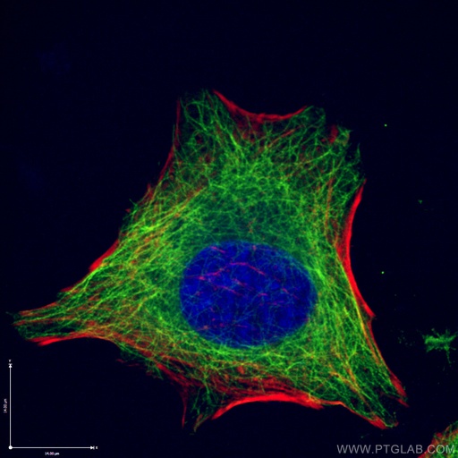 [66240-1-IG-150UL] Beta Tubulin Monoclonal antibody