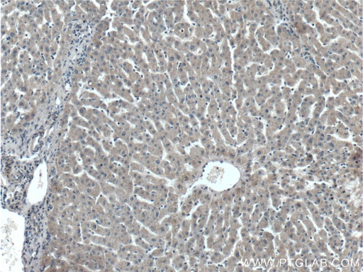 [66242-1-IG-150UL] C4 Gamma Chain Monoclonal antibody