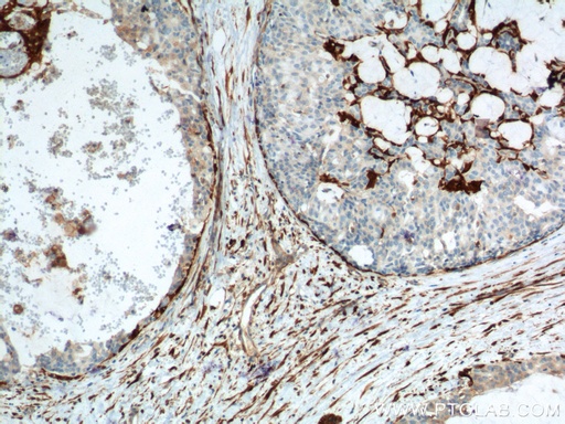 [66244-1-IG-20UL] CNN2 Monoclonal antibody