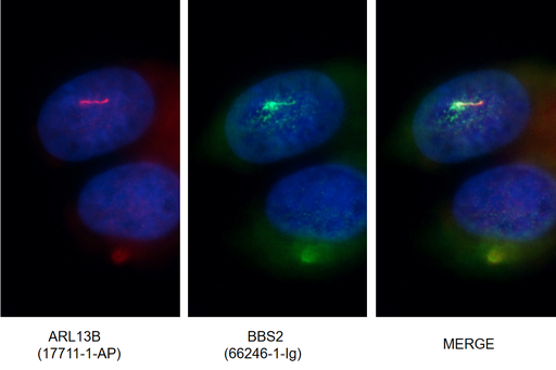 [66246-1-IG-150UL] BBS2 Monoclonal antibody