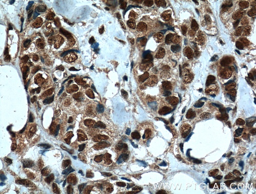 [66247-1-IG-20UL] IMP3 Monoclonal antibody