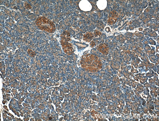 [66253-1-IG-20UL] GNAS Monoclonal antibody