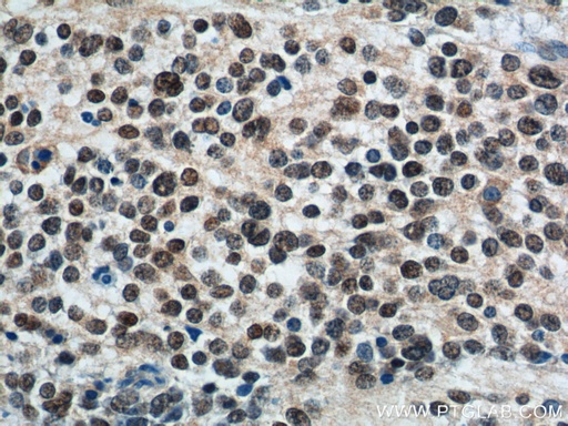 [66254-1-IG-20UL] PHOX2B Monoclonal antibody
