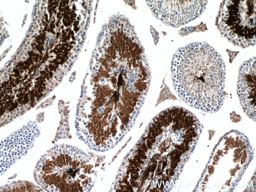[66255-1-IG-20UL] AKAP3 Monoclonal antibody