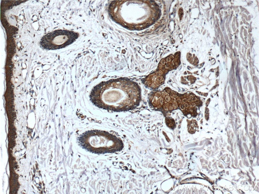 [66257-1-IG-150UL] CD1d Monoclonal antibody