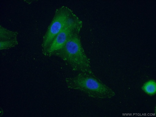 [66258-1-IG-20UL] FAK Monoclonal antibody