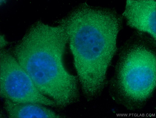 [66260-1-IG-20UL] Alpha 1B-Glycoprotein Monoclonal antibody