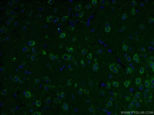 [66265-1-IG-20UL] KGA/GAC Monoclonal antibody