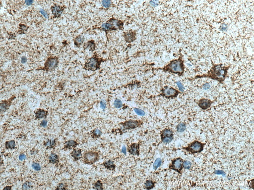 [66265-2-IG-20UL] KGA-Specific Monoclonal antibody