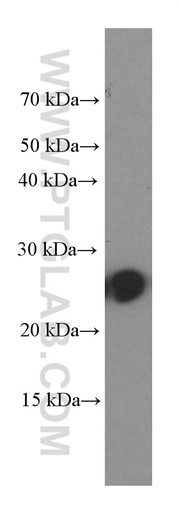 [66268-1-IG-150UL] C1qC Monoclonal antibody
