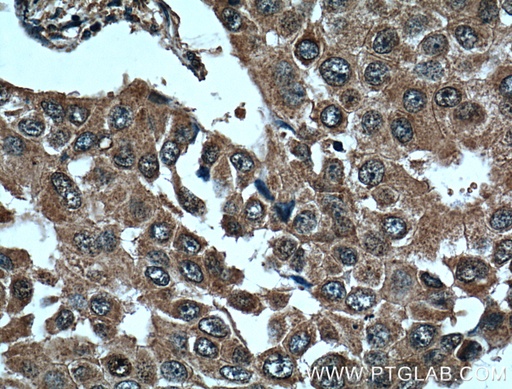 [66269-1-IG-150UL] L2HGDH Monoclonal antibody