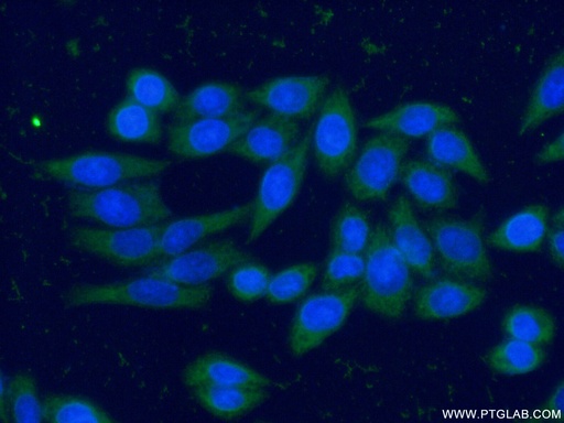 [66277-1-IG-20UL] CAPG Monoclonal antibody