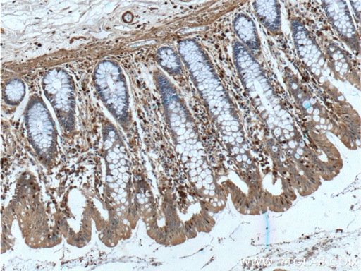 [66280-1-IG-20UL] Gelsolin Monoclonal antibody