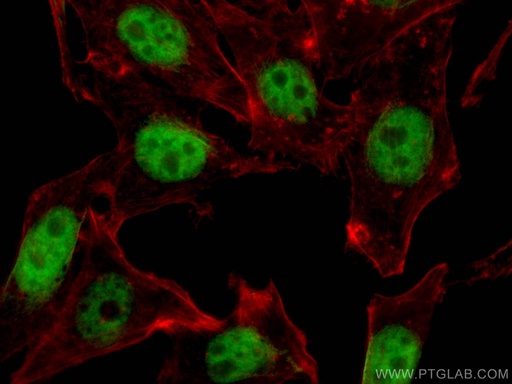 [66281-1-IG-150UL] YY1 Monoclonal antibody