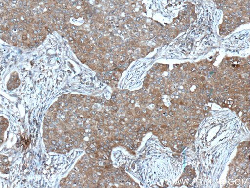 [66283-1-IG-20UL] IGF1R Beta Chain Monoclonal antibody